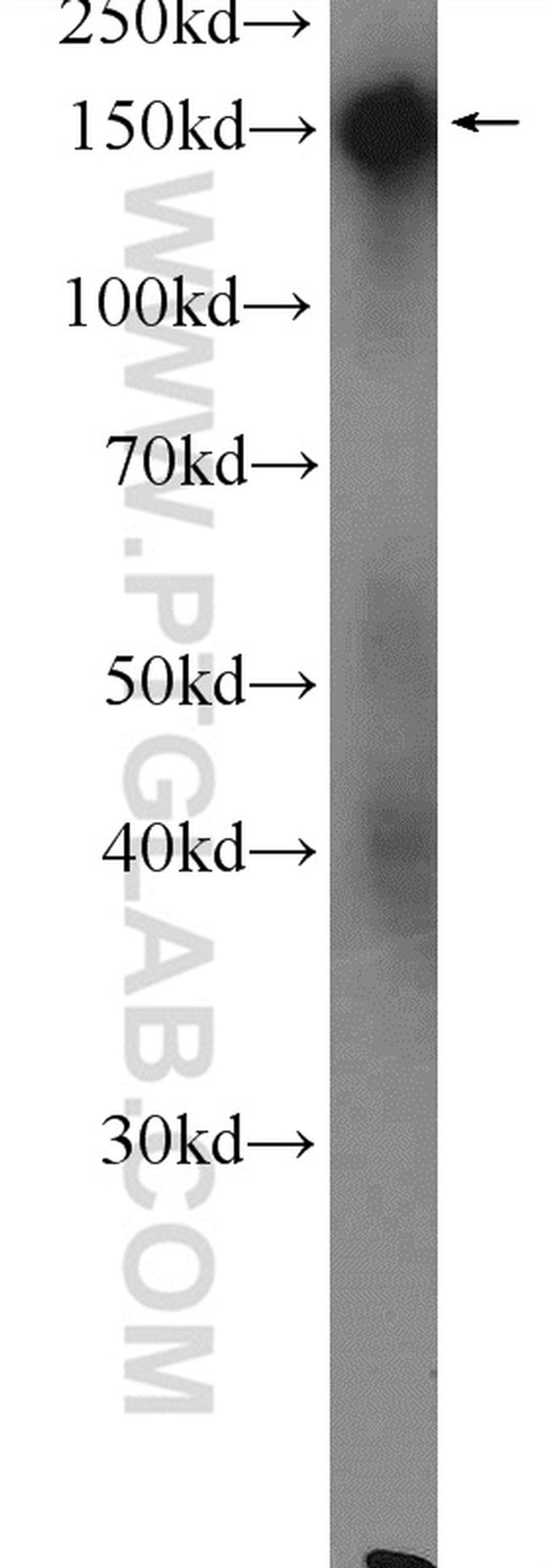 DSG4 Antibody in Western Blot (WB)