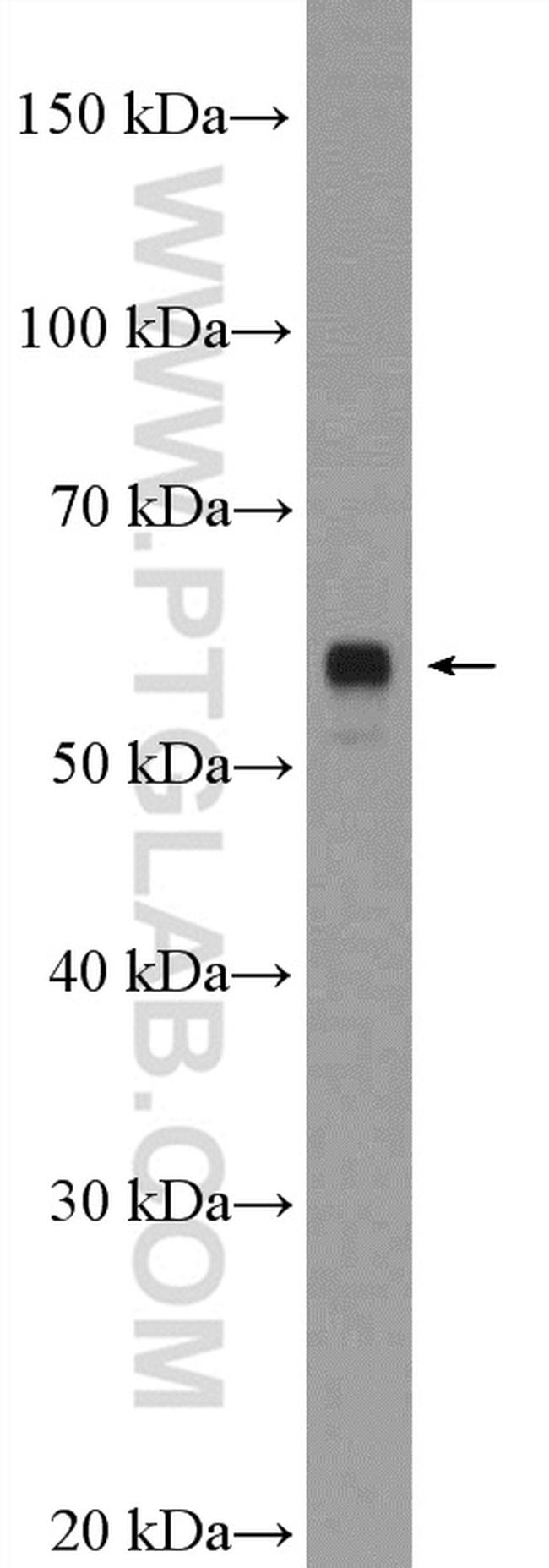 LRRTM2 Antibody in Western Blot (WB)