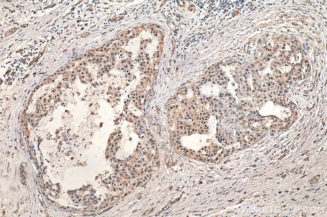 ESRP2 Antibody in Immunohistochemistry (Paraffin) (IHC (P))
