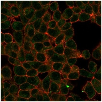 HIC2 (Hypermethylated in cancer 2) (Transcriptional Repressor) Antibody in Immunocytochemistry (ICC/IF)