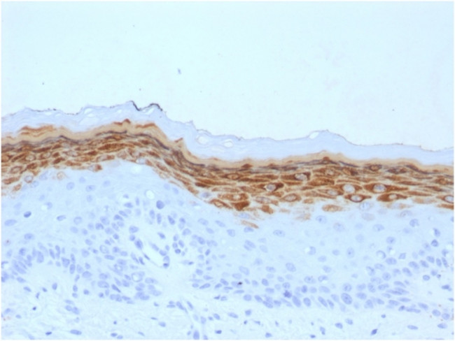 Filaggrin Antibody in Immunohistochemistry (Paraffin) (IHC (P))