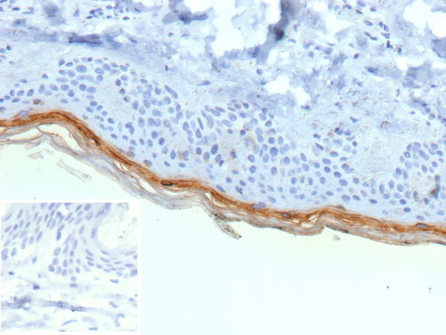 Filaggrin (Keratinocyte Differentiation Marker) Antibody in Immunohistochemistry (Paraffin) (IHC (P))