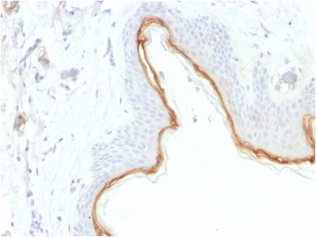 Filaggrin (Keratinocyte Differentiation Marker) Antibody in Immunohistochemistry (Paraffin) (IHC (P))