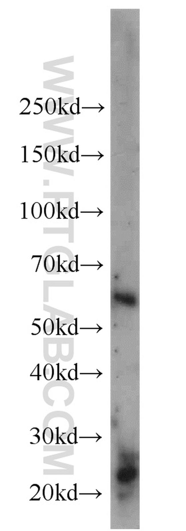 CADM4 Antibody in Western Blot (WB)