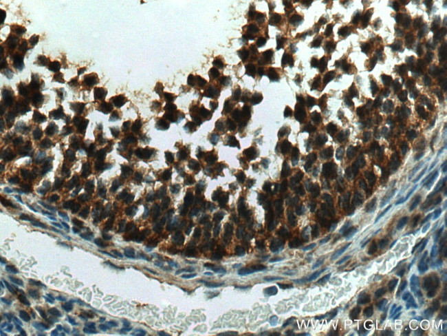 GLIS1 Antibody in Immunohistochemistry (Paraffin) (IHC (P))