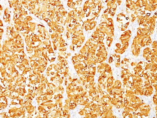 MART-1/Melan-A/MLANA (Melanoma Marker) Antibody in Immunohistochemistry (Paraffin) (IHC (P))