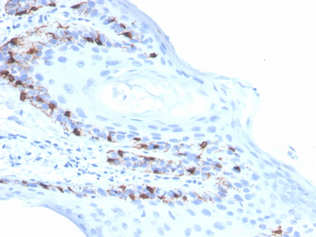 MART-1/Melan-A/MLANA Antibody in Immunohistochemistry (Paraffin) (IHC (P))
