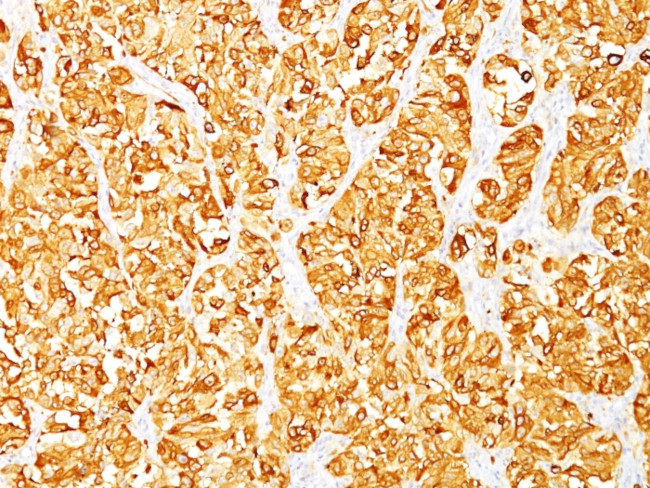 MART-1/Melan-A/MLANA (Melanoma Marker) Antibody in Immunohistochemistry (Paraffin) (IHC (P))