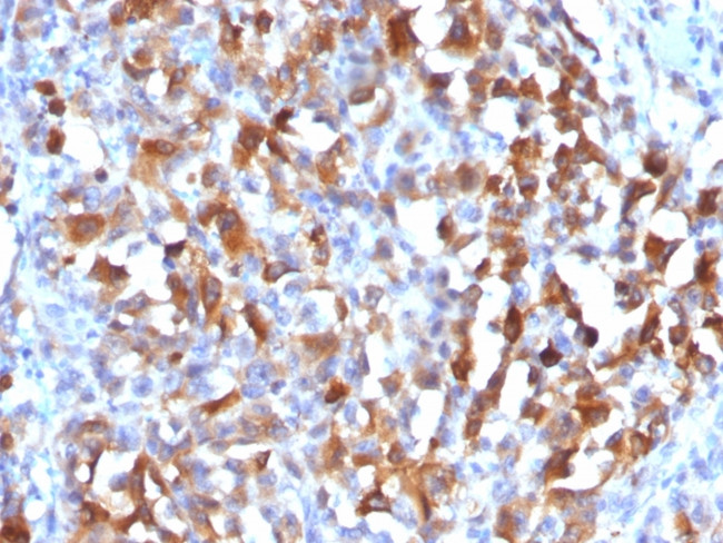 MART-1/Melan-A/MLANA (Melanoma Marker) Antibody in Immunohistochemistry (Paraffin) (IHC (P))