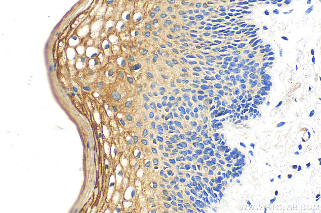 GOLPH3L Antibody in Immunohistochemistry (Paraffin) (IHC (P))