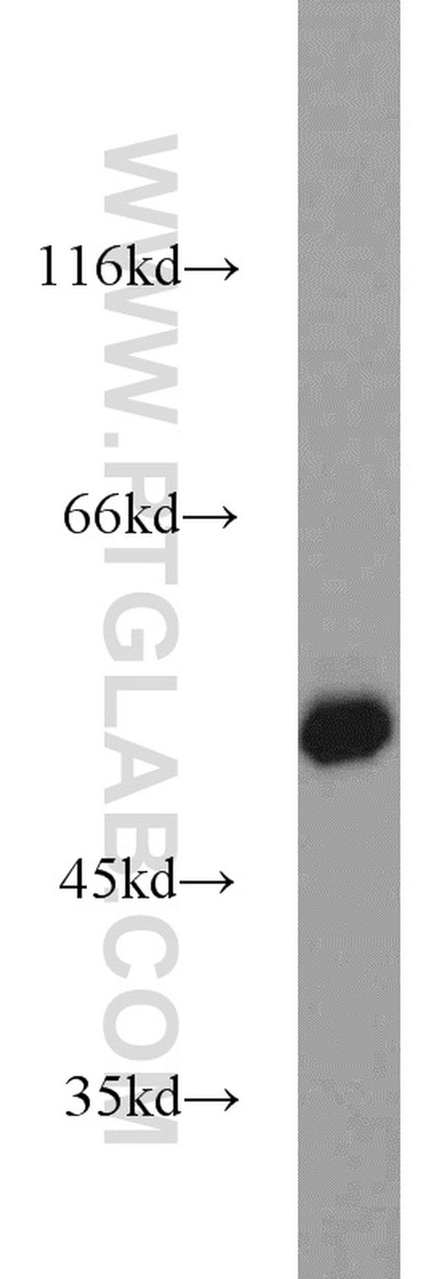 ZSCAN21 Antibody in Western Blot (WB)