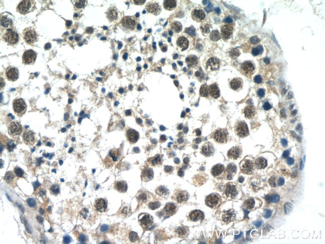 ATXN3L Antibody in Immunohistochemistry (Paraffin) (IHC (P))