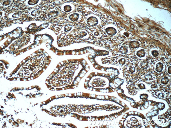 ZFR Antibody in Immunohistochemistry (Paraffin) (IHC (P))