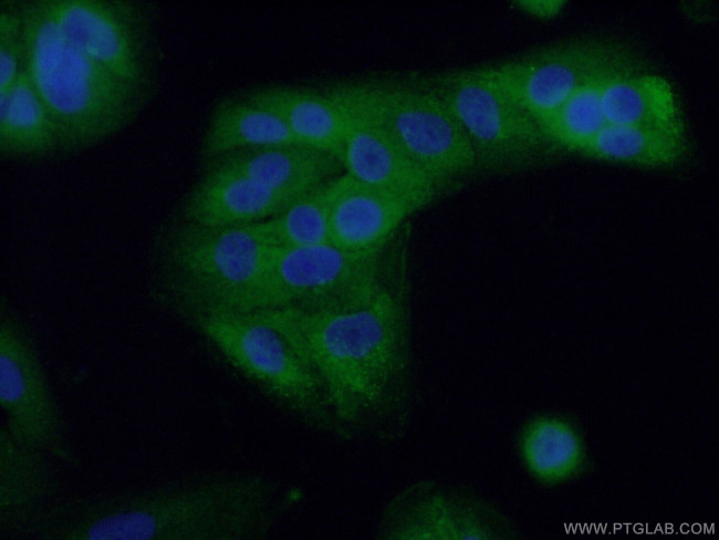 RHBDF2 Antibody in Immunocytochemistry (ICC/IF)