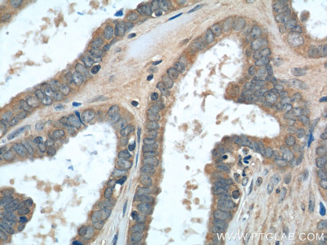 TMEM77 Antibody in Immunohistochemistry (Paraffin) (IHC (P))