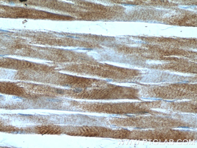 MMADHC Antibody in Immunohistochemistry (Paraffin) (IHC (P))