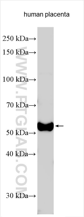 KCTD8 Antibody in Western Blot (WB)