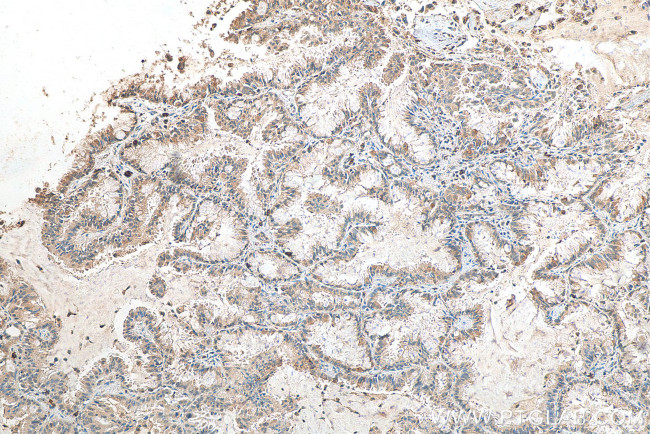 CIP2A Antibody in Immunohistochemistry (Paraffin) (IHC (P))