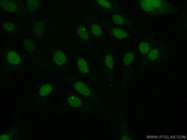 EVI1 Antibody in Immunocytochemistry (ICC/IF)