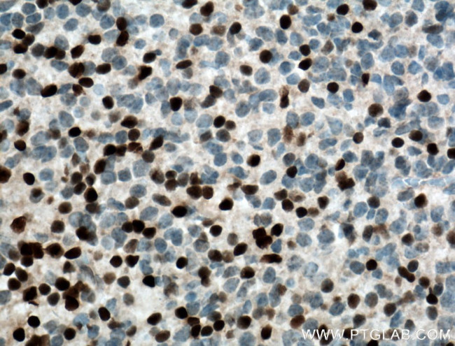 DLX6 Antibody in Immunohistochemistry (Paraffin) (IHC (P))