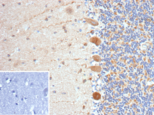 Flt3/CD135 Antibody in Immunohistochemistry (Paraffin) (IHC (P))