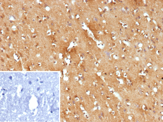 Flt3/CD135 Antibody in Immunohistochemistry (Paraffin) (IHC (P))