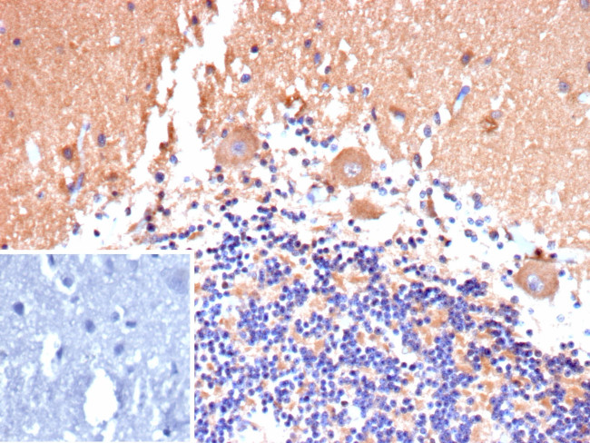 Flt3/CD135 Antibody in Immunohistochemistry (Paraffin) (IHC (P))