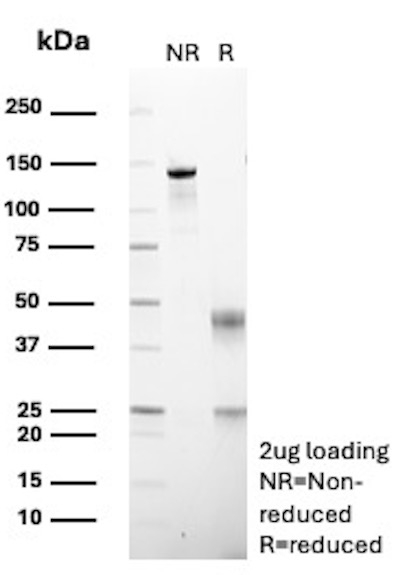 DBC2/RHOBTB2 (Tumor Suppressor) Antibody in SDS-PAGE (SDS-PAGE)