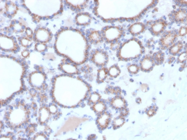 DBC2/RHOBTB2 Antibody in Immunohistochemistry (Paraffin) (IHC (P))