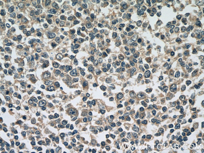 ATG2A Antibody in Immunohistochemistry (Paraffin) (IHC (P))
