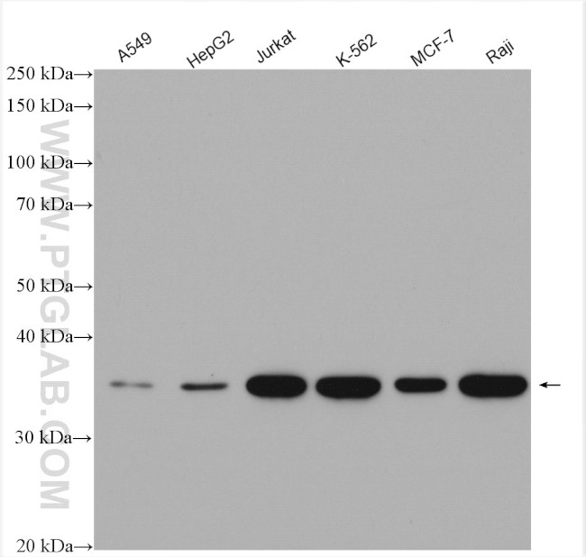 MYD88 Antibody in Western Blot (WB)