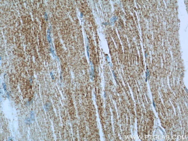 IRGQ Antibody in Immunohistochemistry (Paraffin) (IHC (P))