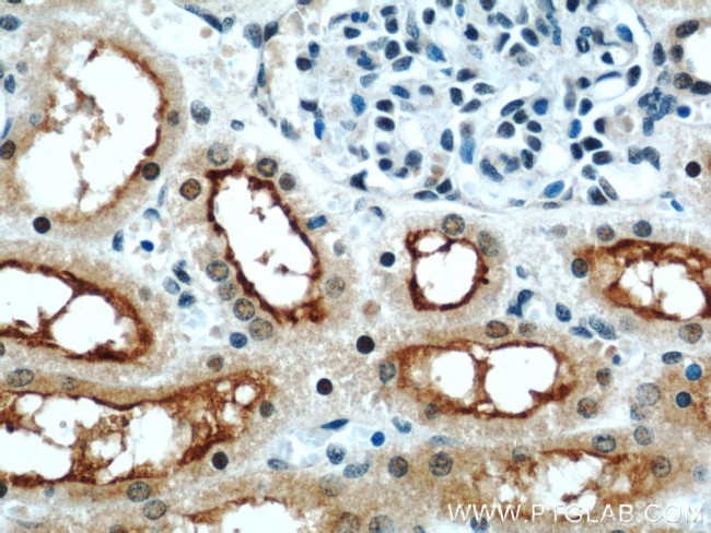 ZNF311 Antibody in Immunohistochemistry (Paraffin) (IHC (P))