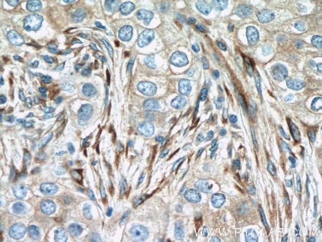 IFIT1 Antibody in Immunohistochemistry (Paraffin) (IHC (P))