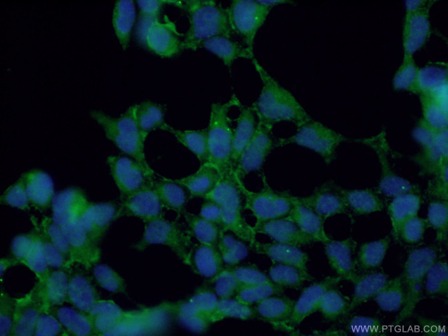 KCNN4 Antibody in Immunocytochemistry (ICC/IF)