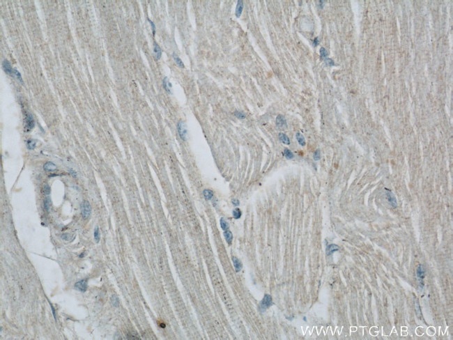 UPF3B Antibody in Immunohistochemistry (Paraffin) (IHC (P))