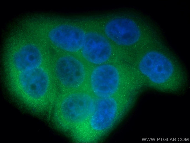 LGALS3BP Antibody in Immunocytochemistry (ICC/IF)
