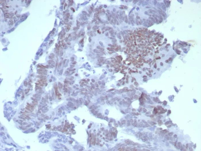 SATB2 (Colorectal Carcinoma Marker) Antibody in Immunohistochemistry (Paraffin) (IHC (P))