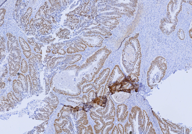 SATB2 (Colorectal Carcinoma Marker) Antibody in Immunohistochemistry (Paraffin) (IHC (P))
