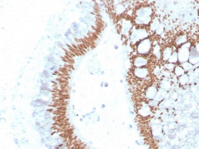 SATB2 Antibody in Immunohistochemistry (Paraffin) (IHC (P))