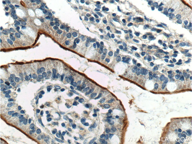 GPR39 Antibody in Immunohistochemistry (Paraffin) (IHC (P))