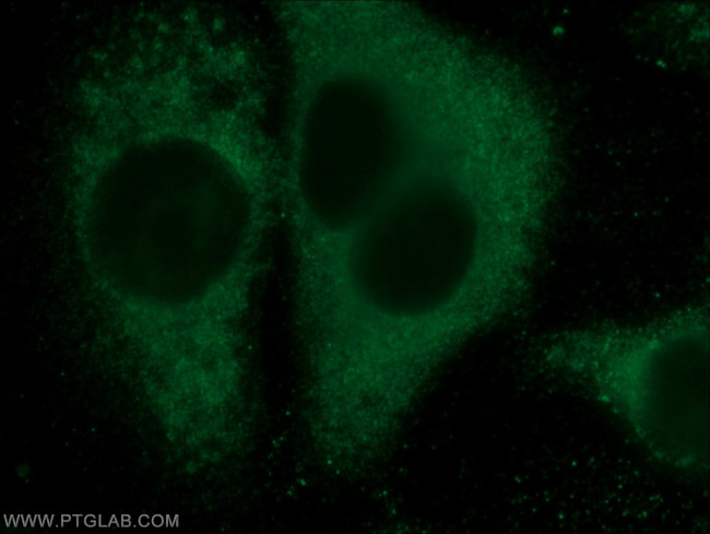 Eg5 Antibody in Immunocytochemistry (ICC/IF)