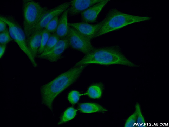 TOPBP1 Antibody in Immunocytochemistry (ICC/IF)