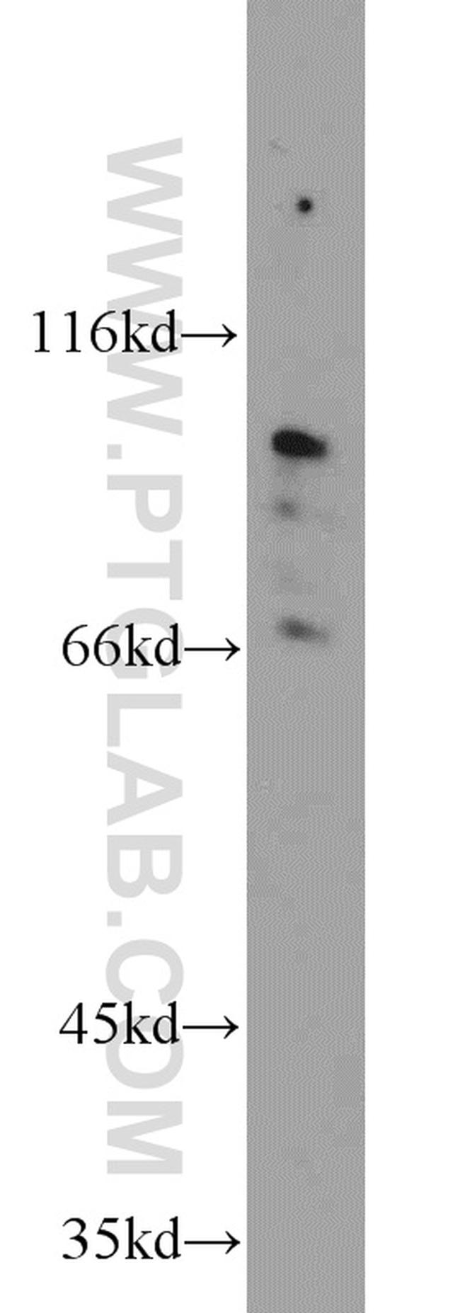 TMTC1 Antibody in Western Blot (WB)