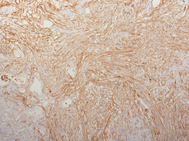 Fibronectin (Cellular and Plasma) Antibody in Immunohistochemistry (Paraffin) (IHC (P))