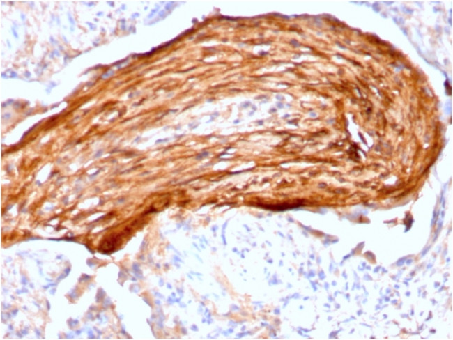 Fibronectin Antibody in Immunohistochemistry (Paraffin) (IHC (P))