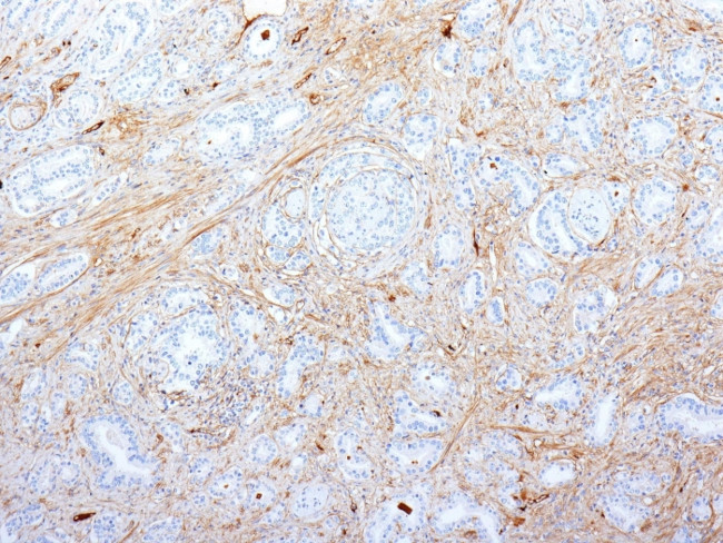 Fibronectin Antibody in Immunohistochemistry (Paraffin) (IHC (P))