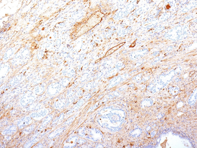 Fibronectin Antibody in Immunohistochemistry (Paraffin) (IHC (P))