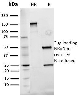 Fibronectin Antibody in SDS-PAGE (SDS-PAGE)