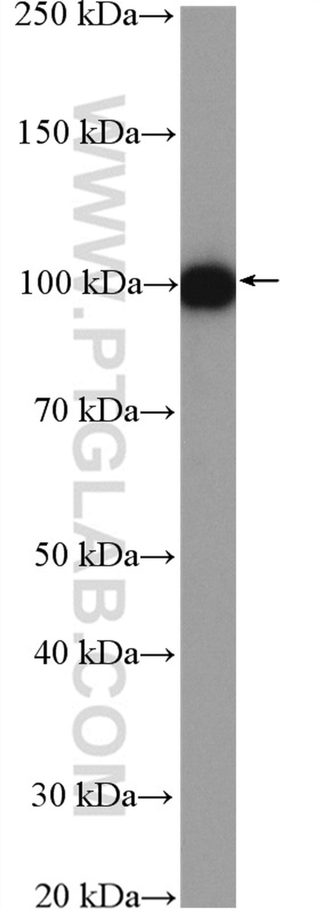 AMOTL2 Antibody in Western Blot (WB)